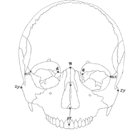 Frontal View Of Cranium Showing Landmarks Used In The Present Study