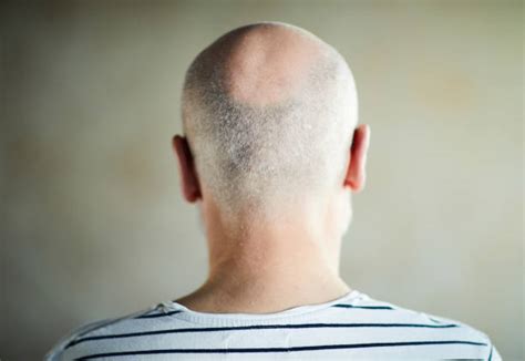 Old Man Back Of Head Stock Photos Pictures And Royalty Free Images Istock
