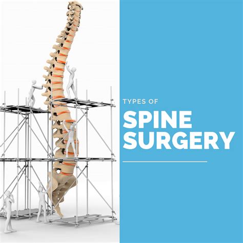 Blogs Comprehensive Spine Care