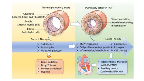 Pathological Mechanisms And Potential Therapeutic Targets Of Pulmonary
