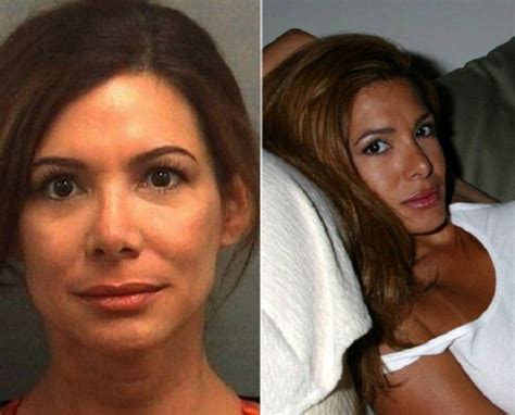 Two Women Are Shown Before And After Plastic Surgery
