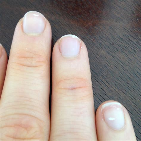 List Of White Spots On Fingernails Deficiency 2022 Inya Head
