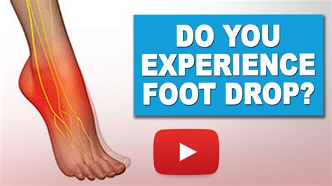 Exercises To Manage Foot Drop Ms Exercises Youtube