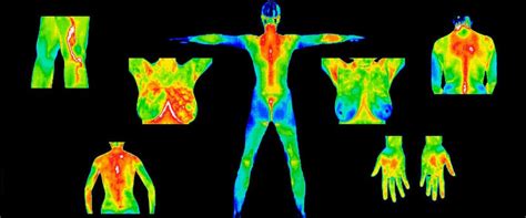 Thermography Thermographic Diagnostic Imaging