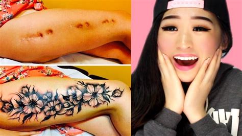 Amazing Tattoos That Turn Scars Into Works Of Art Youtube