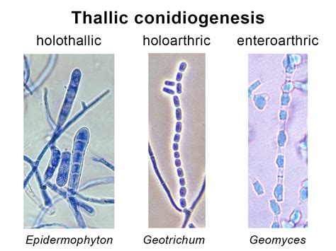 Hyphomycetes Conidial Moulds Mycology University Of Adelaide