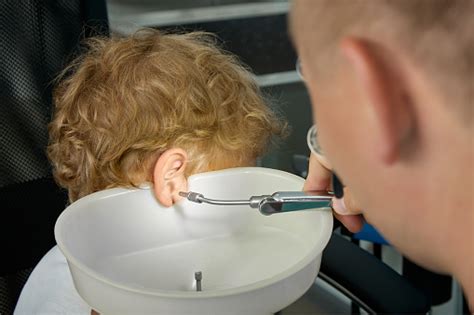 Procedure For Cleaning Childrens Ears From Ear Plugs In The Ent Room