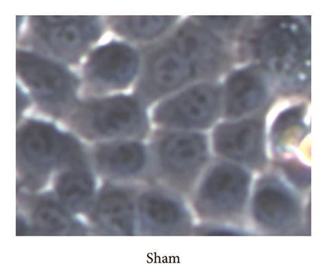 Ginsenoside Rg Protected Hbe Cells Against Cse Or Tgf Induced Emt