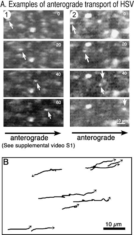 Fast Anterograde Transport Of Gfp Hsv In The Squid Giant Axon A