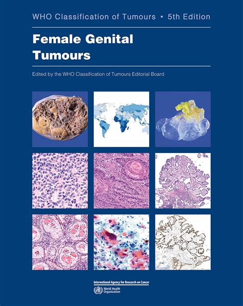 Who Classification Of Female Genital Tumours Who Classification Of Tumours 4 World Health