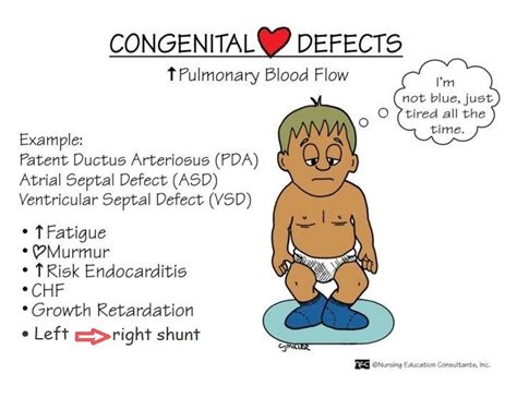Cardiac Defects 34010 202002 Congenital Heart Defect Nurse