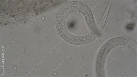 Stockvideon Parasite Strongyloides Stercoralis From Human Feces Under