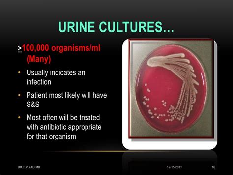 Ppt Interpretation Of Urine Cultures Powerpoint Presentation Id212996