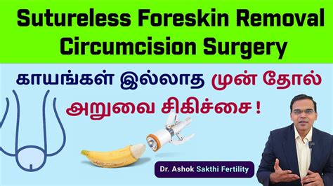 Sutureless Foreskin Removal Circumcision Surgery காயங்கள் இல்லாத முன் தோல் அறுவை சிகிச்சைdr