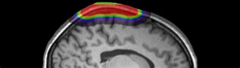 Program Diffuse Optical Imaging Workshop University Of Illinois At