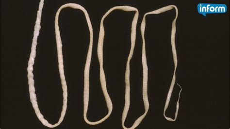 Live Tapeworm Still Wiggling Removed From California Mans Brain