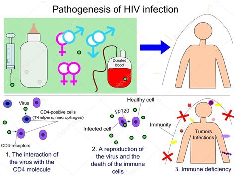 Pathogenesis Of Hiv Infection Stock Vector Image By ©sandro 105732006