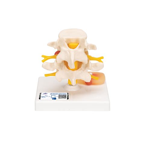 Anatomical Teaching Models Plastic Vertebrae Model Lumbar Spinal Column