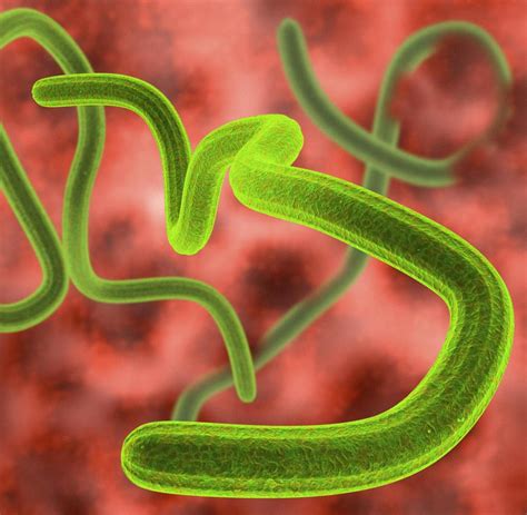 Få 10.000 endnu en ebola virus moving under microscope. Epidemie: Neuer Virus-Stamm verursacht tödliche Ebola ...
