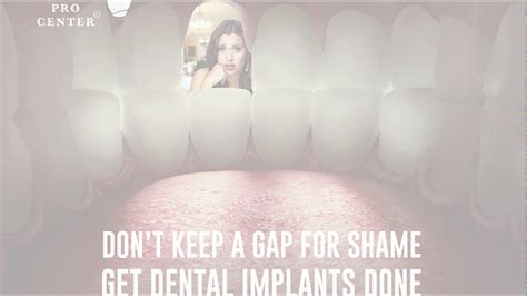 46 how to get rid of gaps in my teeth. Don't Keep A Gap For Shame Get Dental Implants Done. - YouTube