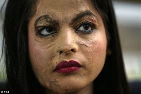 Acid Attack Victims In India Mark Iwd 2018 With A Fashion Show Daily Mail Online