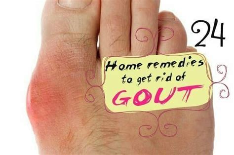 Does Gout Cause Leg Pain
