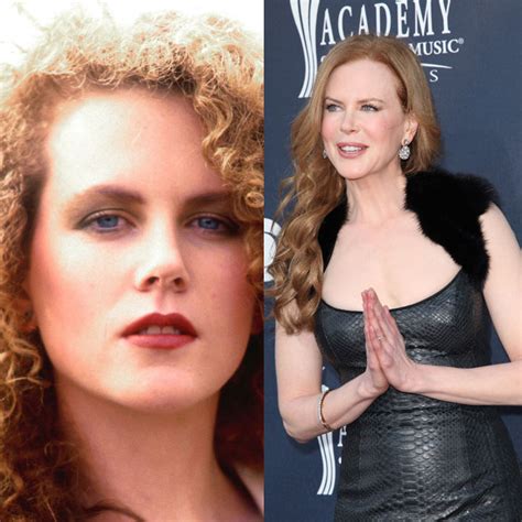 Nicole Kidman Et La Chirurgie Esthétique - Les stars et la chirurgie esthétique : avant / après : Nicole Kidman