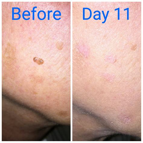 Derma Skin Care Clinic medispa serving West Bend WI Milwaukee WI Mequon