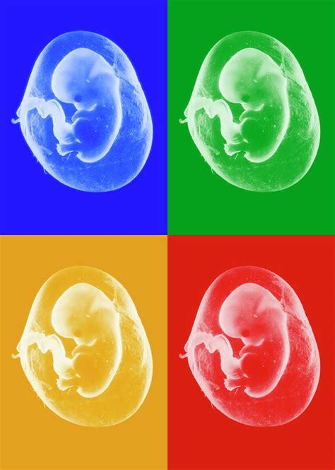 Eight Week Old Foetuses Photograph By Dr Ma Ansaryscience Photo Library