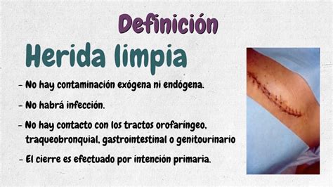 Herida Limpia Definición Manejo Local Manejo Postquirúrgico Youtube