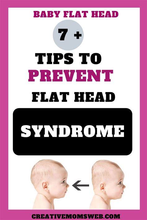 7 Tips To Prevent The Flat Head Syndrome Flat Head Syndrome Flat
