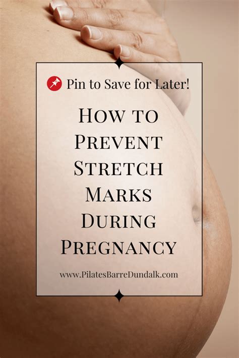 How To Prevent Stretch Marks During Pregnancy • Vitality Pilates And