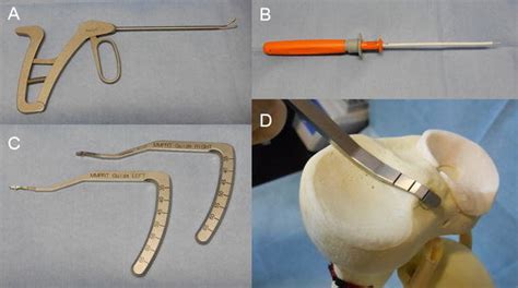 A The Knee Scorpion Suture Passer B The FasT Fix Meniscal Repair Download Scientific