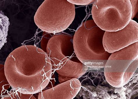 Blood Clot Colored Scanning Electron Micrograph High Res Stock Photo