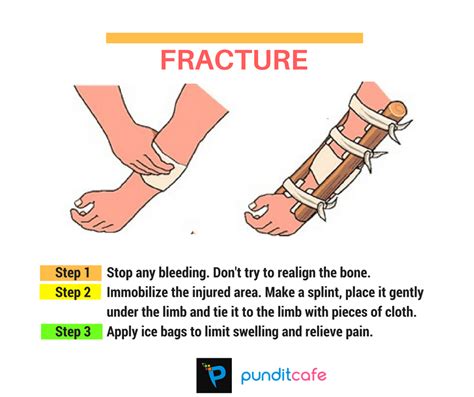 First Aid For Bone Fracture