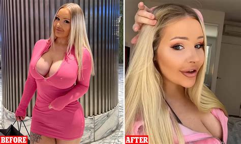 Woman Spends 100 00 On Plastic Surgery To Look Like Barbie
