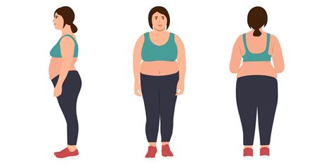 Young Woman With Overweight In Sportswear Woman Obesity Young Female