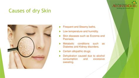 Ppt Dry Skin Treatment Powerpoint Presentation Free Download Id
