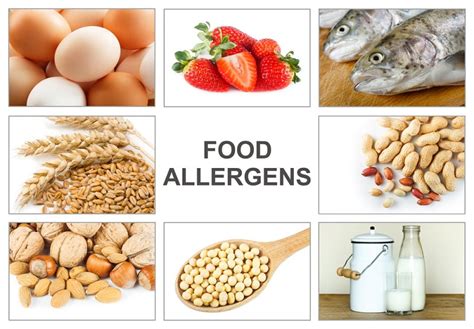 What Are The 8 Most Common Food Allergies Dr Thomas Chacko