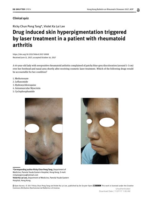 Pdf Drug Induced Skin Hyperpigmentation Triggered By Laser Treatment