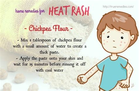 31 Home Remedies For Heat Rash On Face Neck Arms And Legs