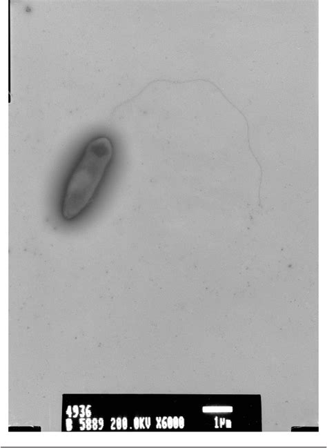 Figure 1 From Ideonella Sakaiensis Sp Nov Isolated From A Microbial