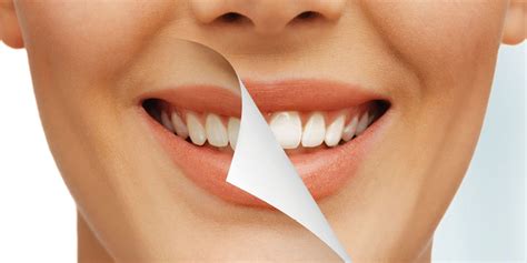 Tooth Whitening Treatments To Achieve A Perfect White Smile Dentaid