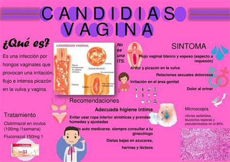 candidiasis vaginal alba daniela arancibia delgado udocz