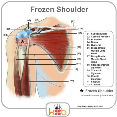 However, they play an incredibly important role in the body. Frozen Shoulder Anatomical Structure | Shoulder muscles, Muscle diagram