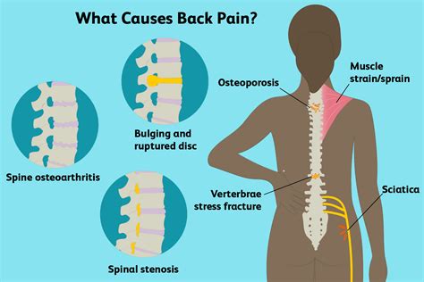 Upper And Lower Back Pain Causes Feeling Very Uneasy On Your Back Get
