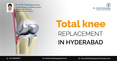 Pin On Knee Replacement Surgery In Hyderabad