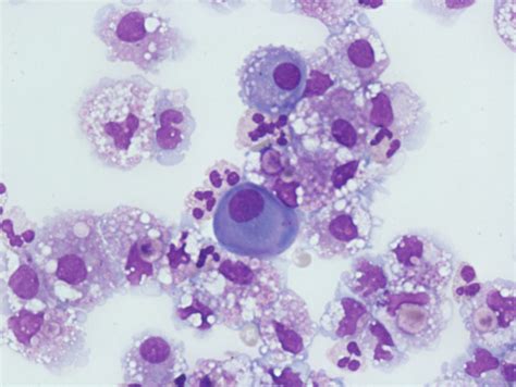 Peritoneal Macrophages