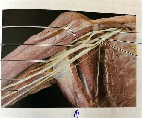 Anatomy Brachial Plexus Flashcards Quizlet Vrogue Co