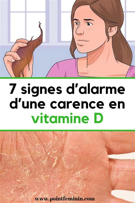 7 Signes De Carence En Vitamine D à Ne Jamais Ignorer Signe Carence